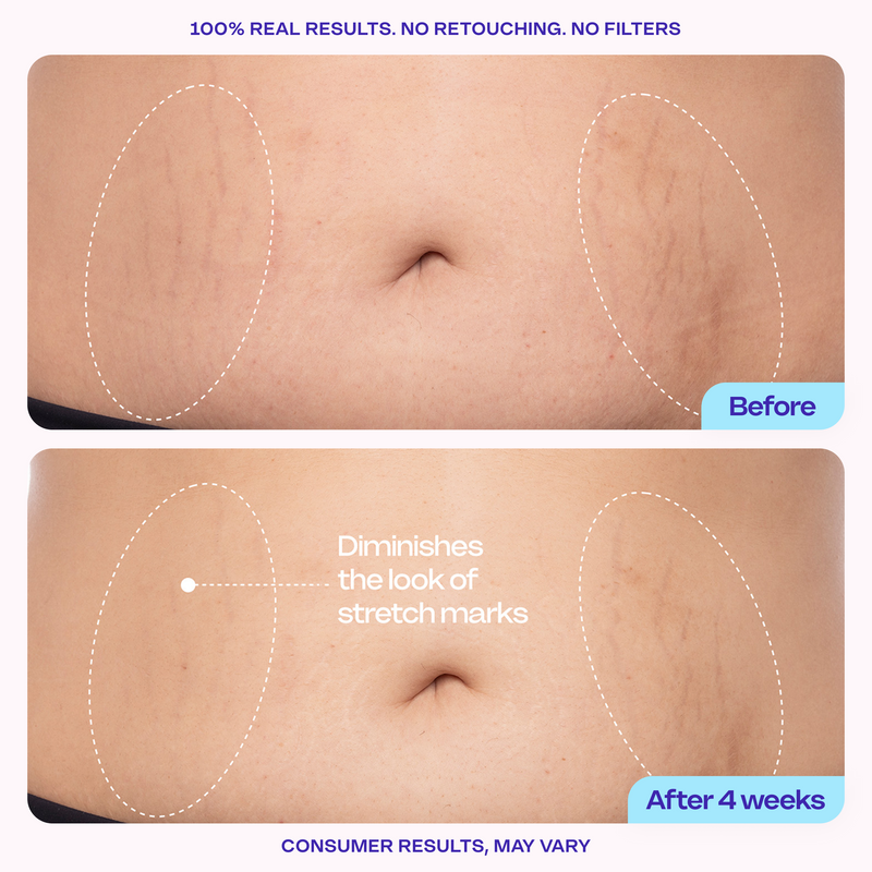 Tighten & Smooth Belly Cream
